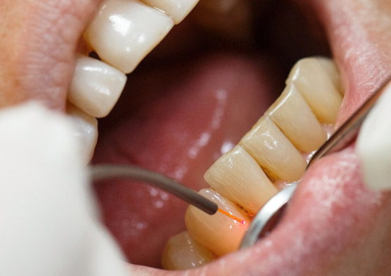 About Gum Disease Midtown Manhattan, NY